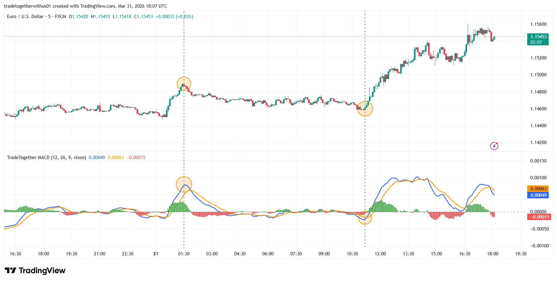 Chapter 17: MACD Indicator Explained in Forex Trading: Combining MACD with Moving Average Crossover Strategy