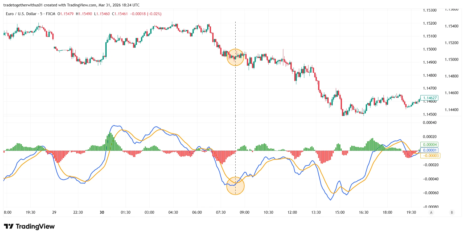 Chapter 17: MACD Indicator Explained in Forex Trading: Combining MACD with Moving Average Crossover Strategy